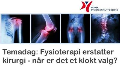 Norsk Fysioterapeutforbund-Temadag: Fysioterapi erstatter kirurgi – når er det et klokt valg? @ Meetando.no